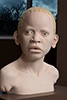 African-child-with-Albinism-2-2