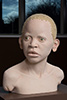 African-child-with-Albinism-2