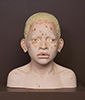 African-child-with-Albinism-3